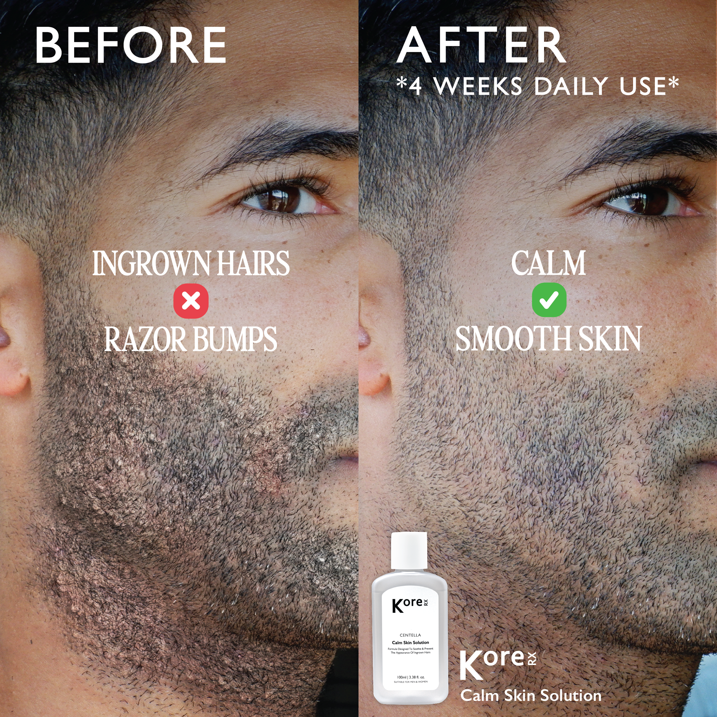 Centella Calm Skin Solution - Image 5