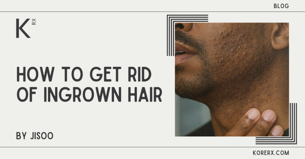 How to Get Rid of Ingrown Hair